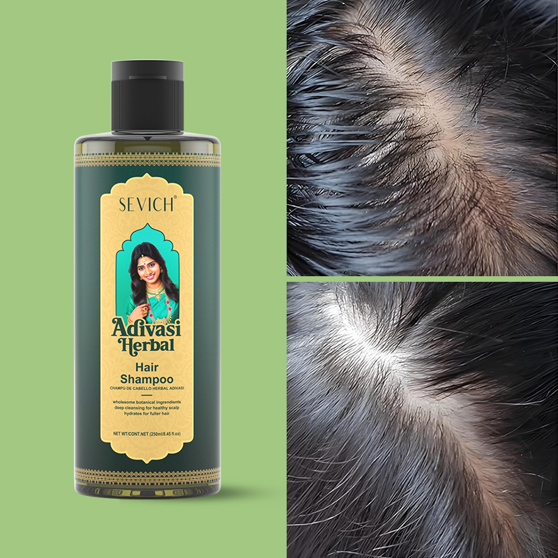 SEVICH Zestaw ziołowych olejkó – Hair Care India recenzja i cena